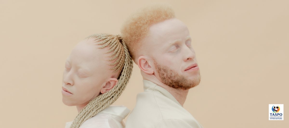 Two people with albinism standing back to back